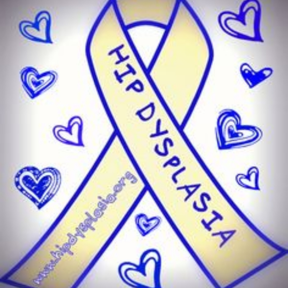 Hip dysplasia
